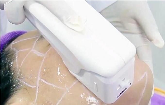 máquina de ajuste vaginal del hifu 300W con 15,4” pantallas táctiles del color